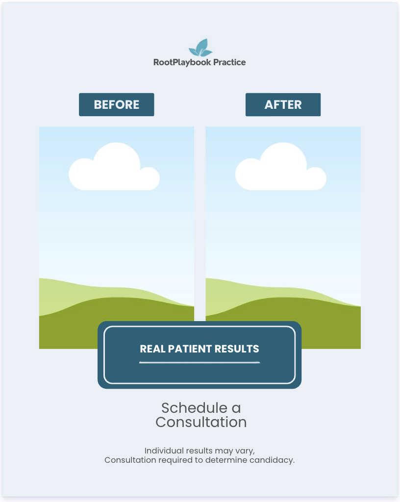 Side-by-side result template preview